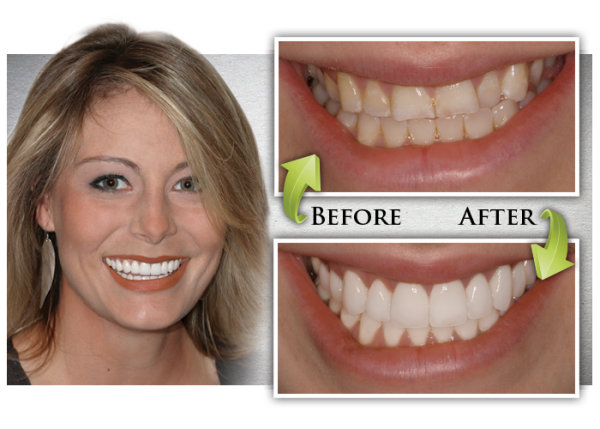 how to plan dental trip to Costa Rica, dental tourism packages, dental vacation Costa Rica, Costa Rica medical tourism