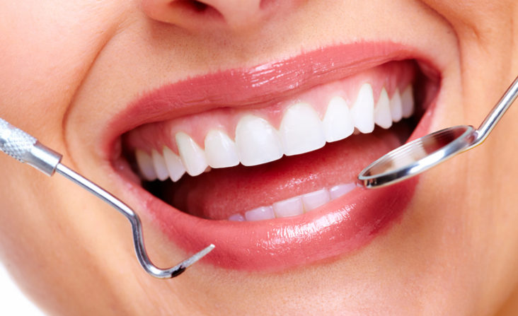 dental implants Costa Rica, veneers in Costa Rica, full mouth restoration Costa Rica, affordable smile makeover, Costa Rica dental clinic